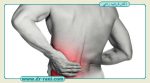 درد عصب سیاتیک کمر و پا چه علائمی دارد؟
