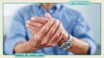 آرتریت دست چیست و چگونه در مان می‌شود؟