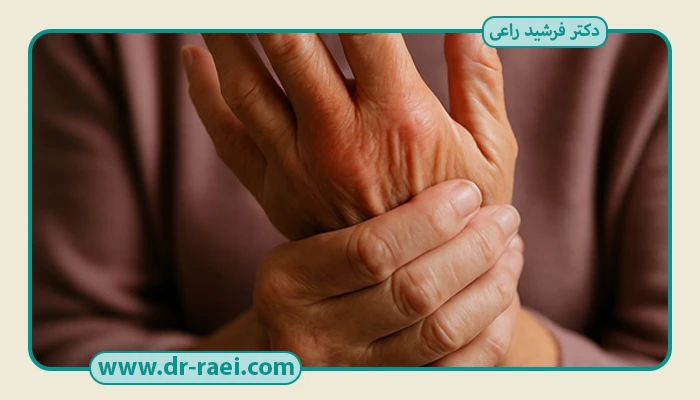 درمان کیست مچ دست