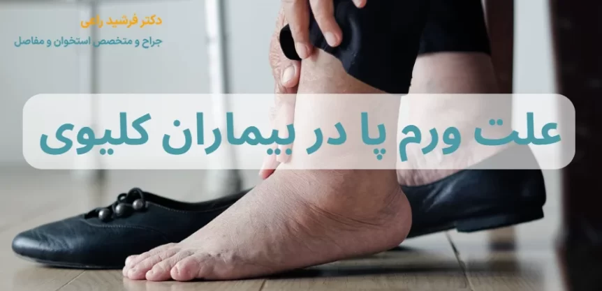 علت ورم پا در بیماران کلیوی