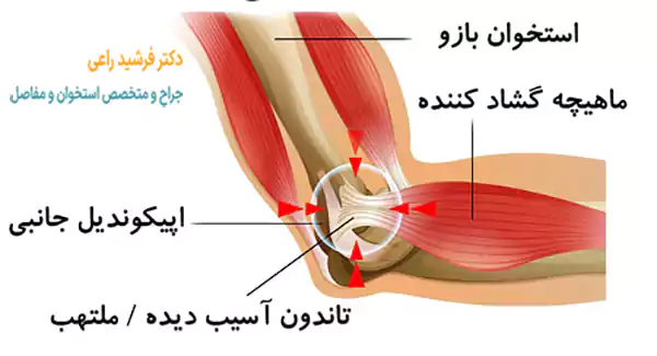 تنیس البو