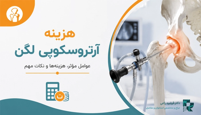 چه افرادی ممکن است به عمل آرتروسکوپی لگن نیاز داشته باشند؟